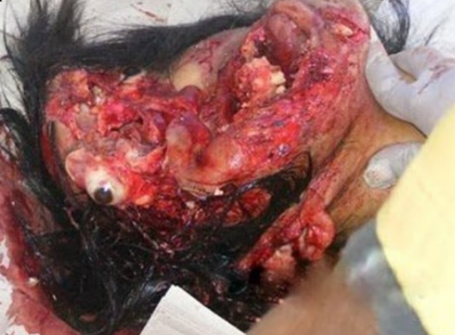 松山協和病院口コミ